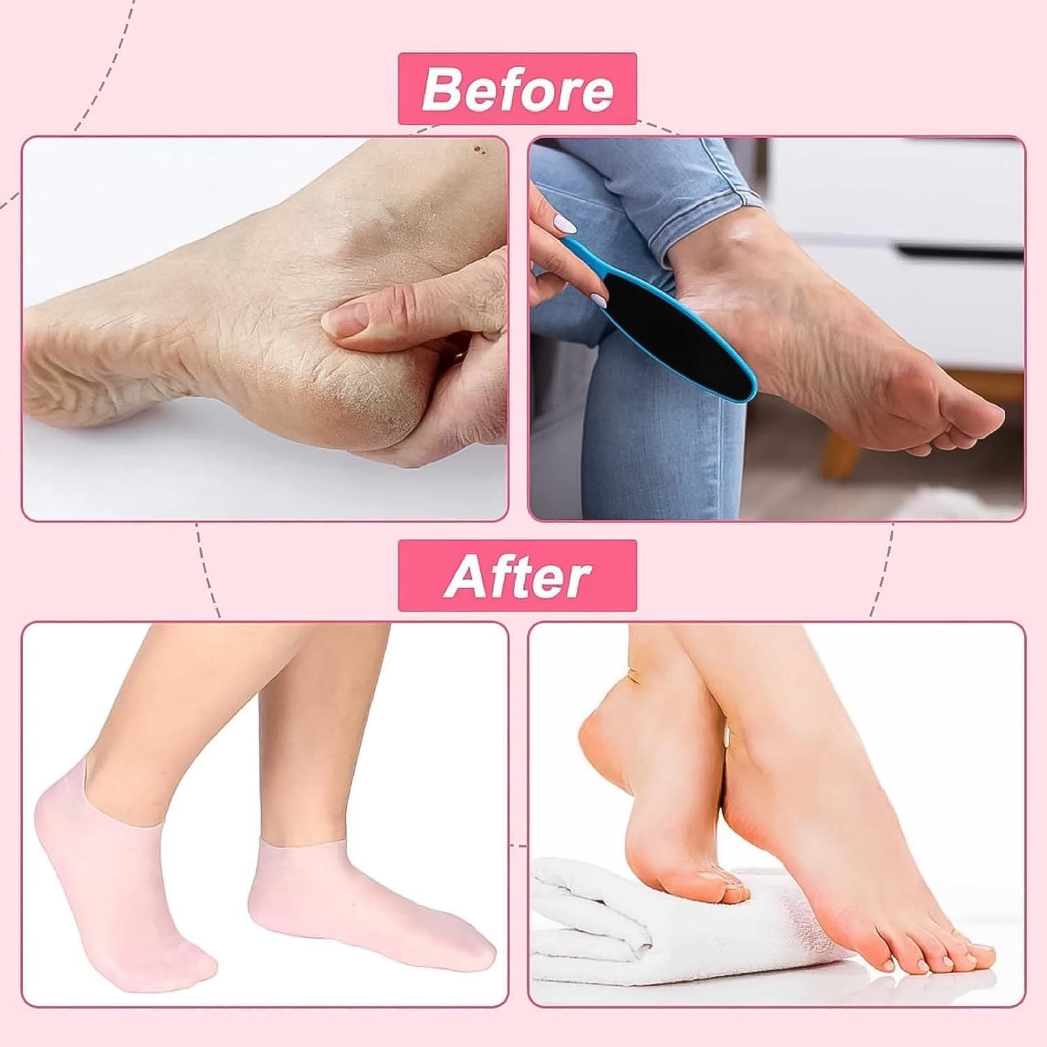 Silicone Moisturizing Socks (1 Pair) Silicone Moisturizing Socks (1 Pair)